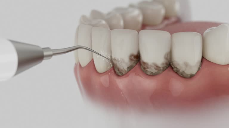 Reliable Dental Implants contractor in California, CA by Dentist Open Now